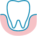 歯周病治療